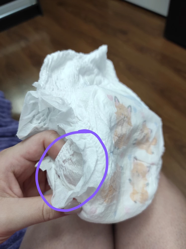 Трусики протекают. Мы весим 7 кг, по весу трусики подходят, но если попадает на место, где ножки, то все протекает (отметила на фото)