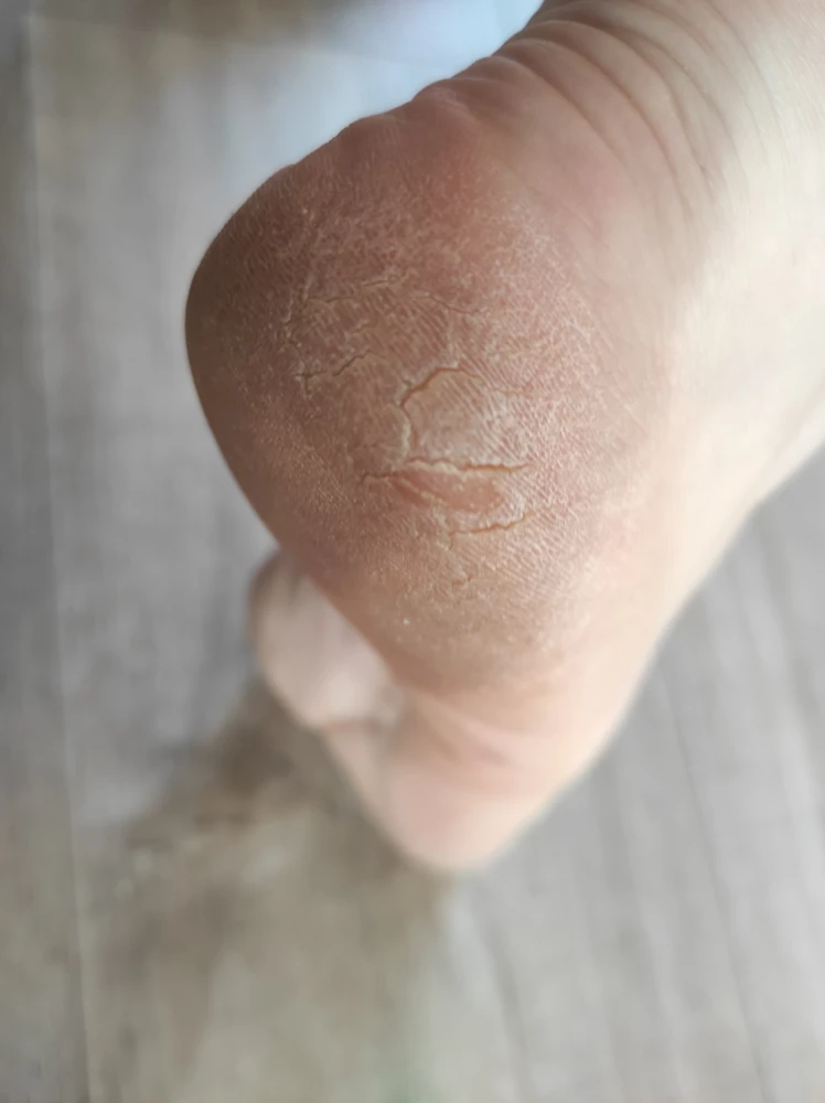 Классная терка