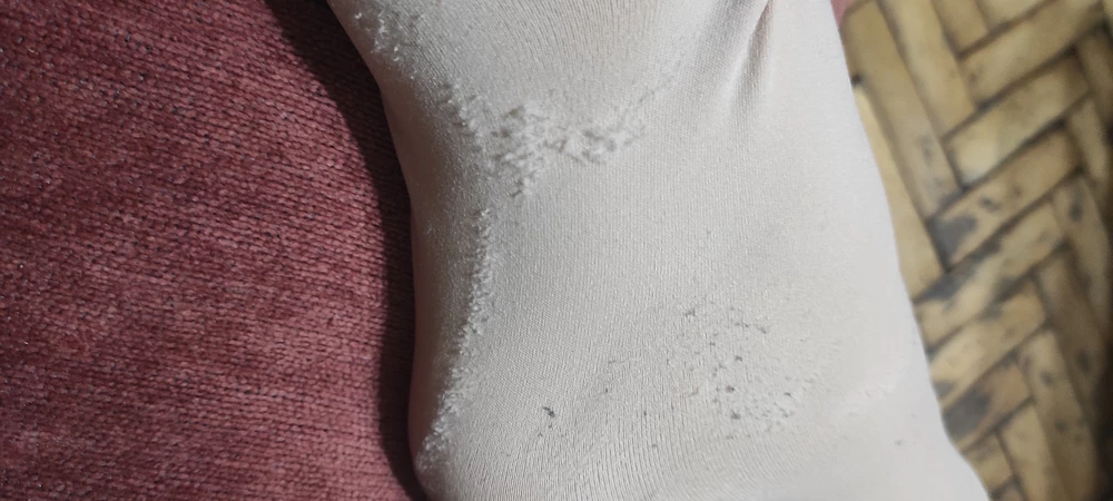 Только надела, сразу ткань скаталась в зоне обуви, прошло 15 минут ходьбы в обуви, выглядит ужасно, да уж- колготки за почти 800 рублей 🙈